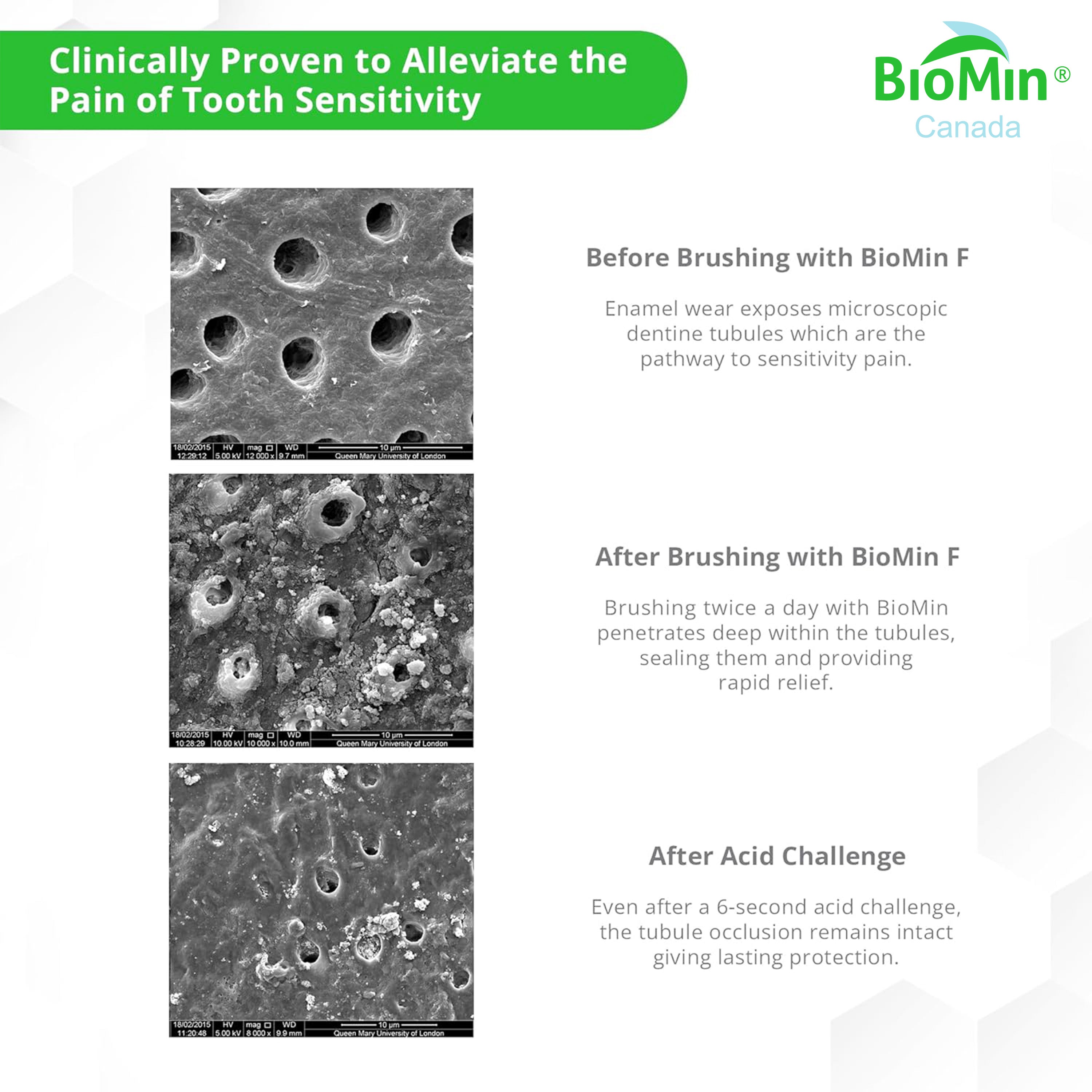 BioMin™ F 75 ml - Dentifrice pour dents sensibles